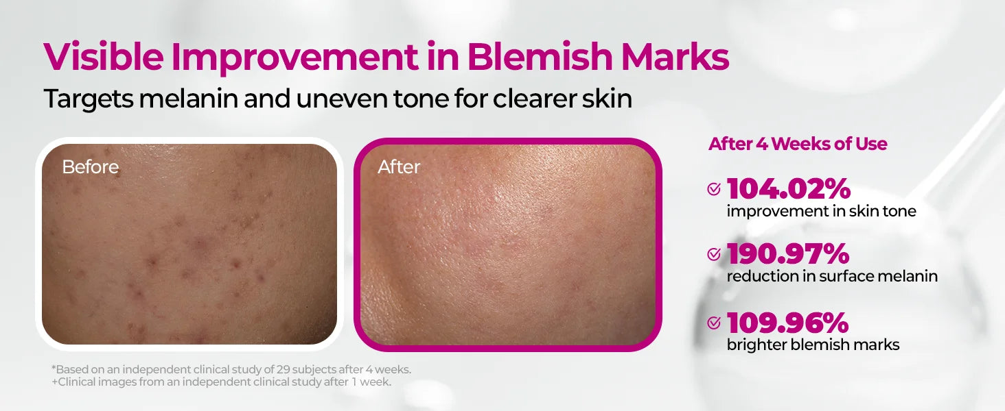 Cemenrete Picotonic Shot Calcium Serum for Firming Density collagen serum Even Skin Tone & Skin Clarity Anti-aging Dark spot