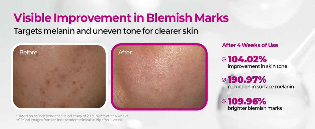 Cemenrete Picotonic Shot Calcium Serum for Firming Density collagen serum Even Skin Tone & Skin Clarity Anti-aging Dark spot