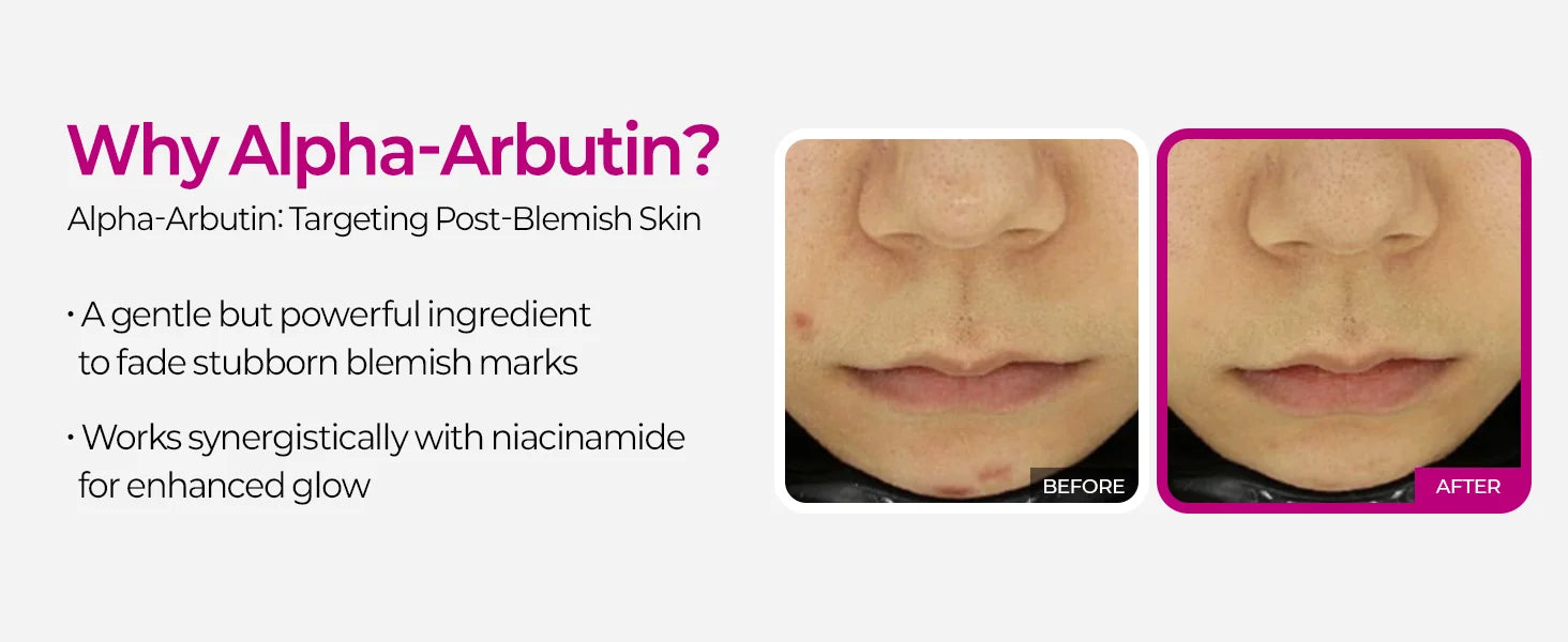 Cemenrete Picotonic Shot Calcium Serum for Firming Density collagen serum Even Skin Tone & Skin Clarity Anti-aging Dark spot
